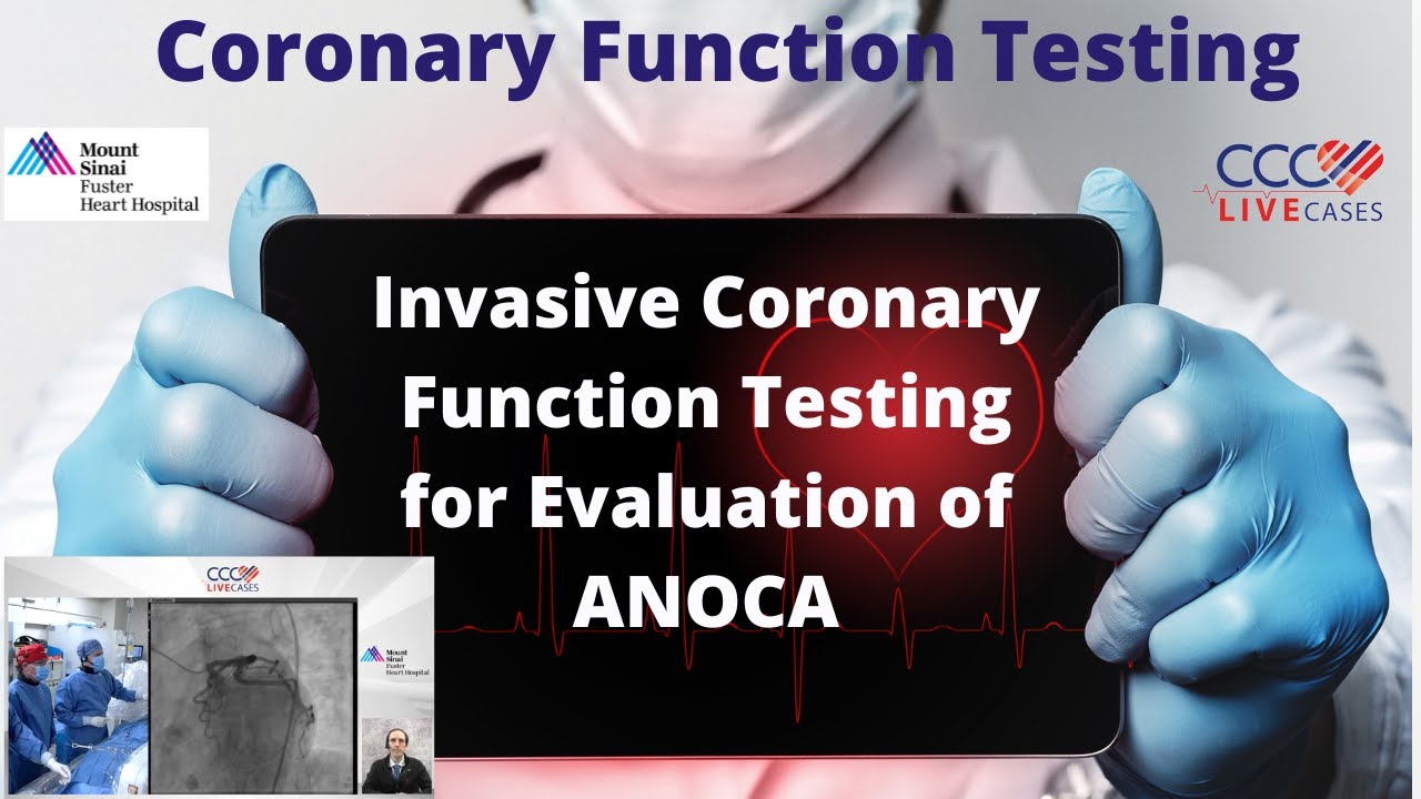 Invasive Coronary Function Testing for Evaluation of ANOCA