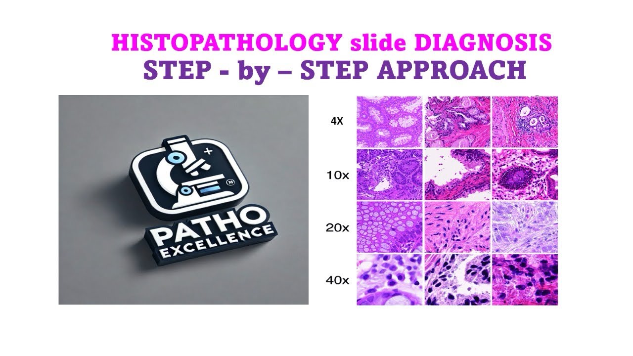 Histopathology Slide Diagnosis 🔬 | Step-by-Step ApproachFrom First Glance to Final Diagnosis!