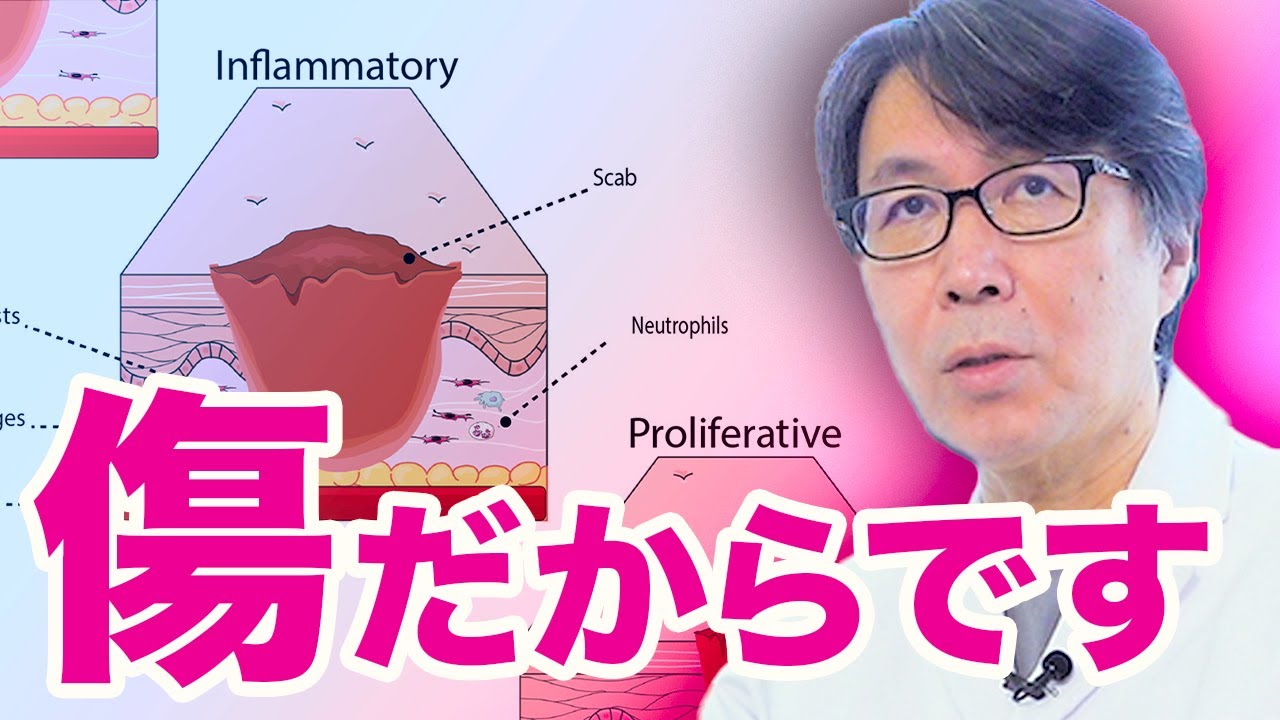 肌再生の専門家が、糸リフトやHIFUが「持っても半年」な理由を解説します