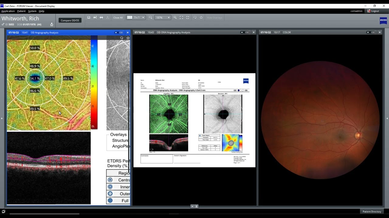 ZEISS FORUM integration at Cliff Williams Independent Optician Kirkcaldy, Fife, Scotland