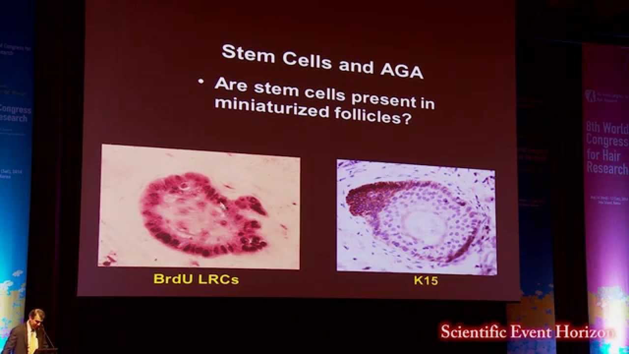 Dr George Cotsarelis: Advances in Understanding Androgenetic Alopecia