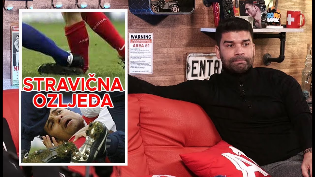 Eduardo o lomu noge - 