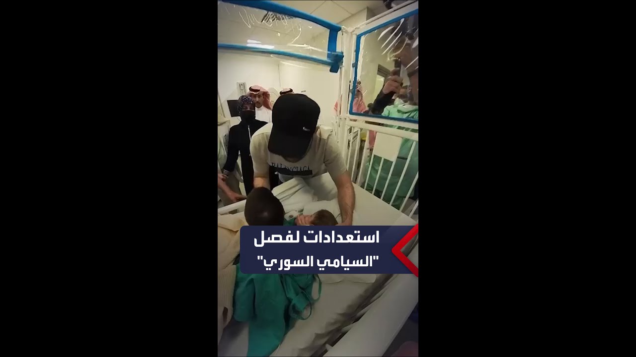 استعدادات لفصل التوأم السيامي السوري في السعودية