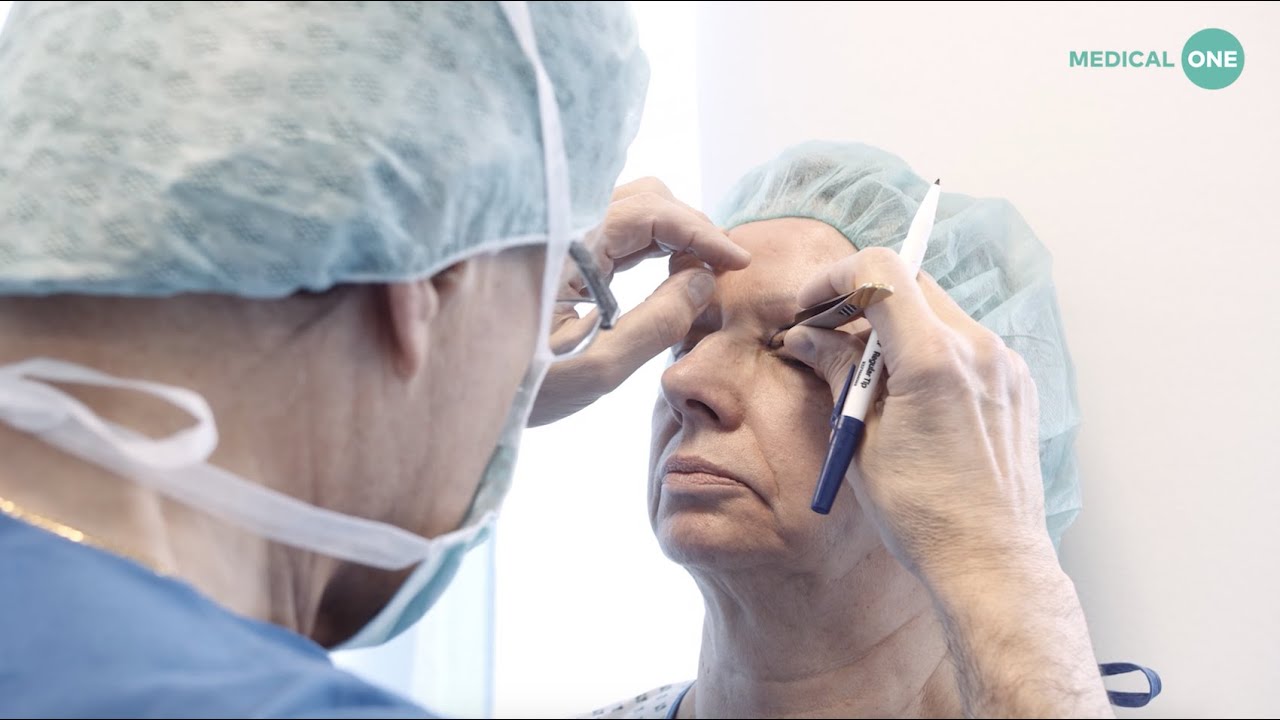 Augenlidstraffung bei Medical One