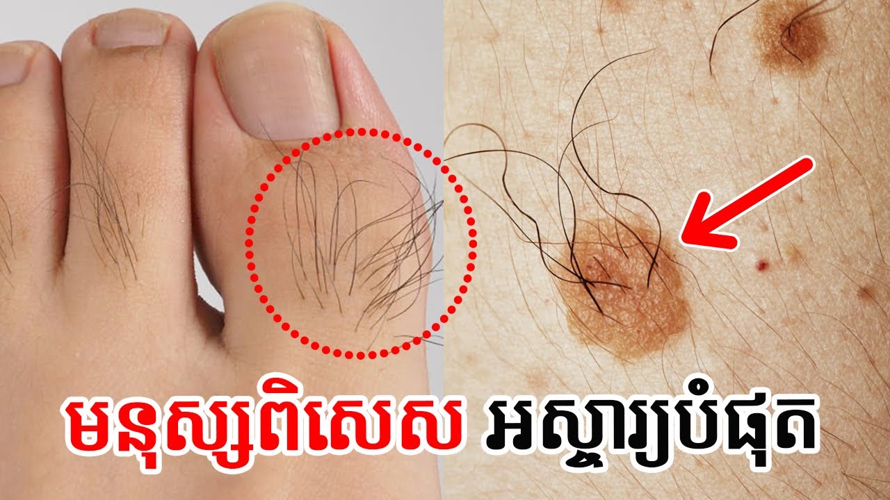 បើមានដុះរោម ៤ កន្លែងនេះ ជាសញ្ញាហុងស៊ុយល្អ នាំលាភសំណាងច្រើនដល់ម្ចាស់ | Personality of lucky people