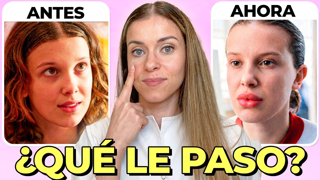 Cambios en la CARA de Millie Bobby Brown explicados por una dermatóloga