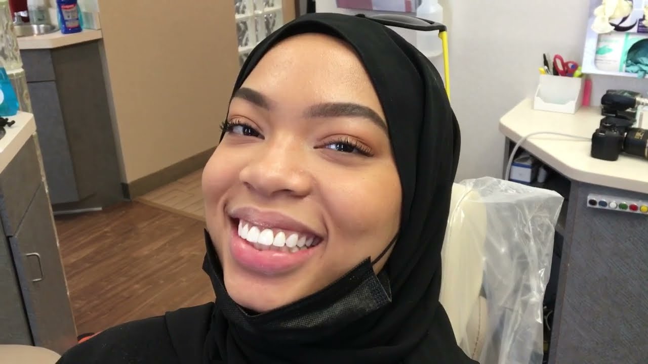 Dr. Steve Marsh of Cleveland Smiles | Gum contouring | 