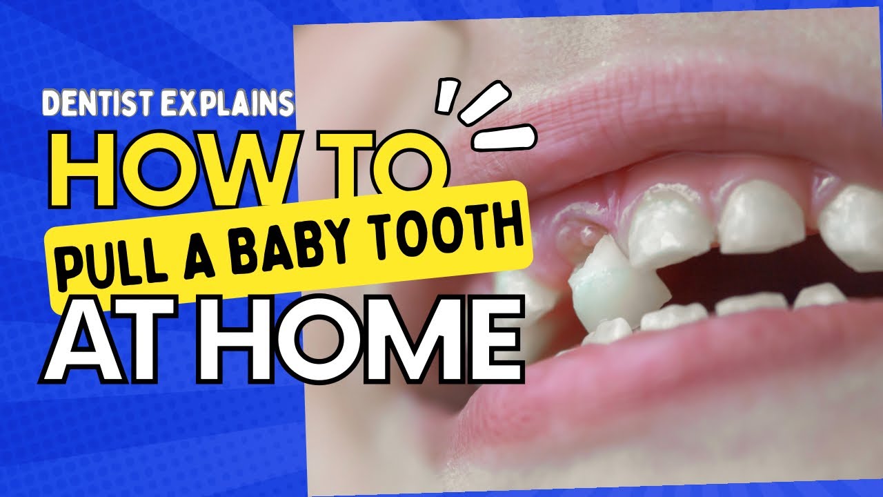 Dentist (@TheTwintists) Explains How to Pull a Baby Tooth at Home