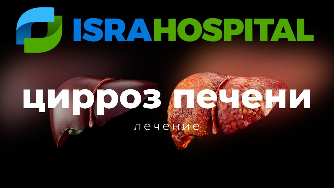 Лечение цирроза печени