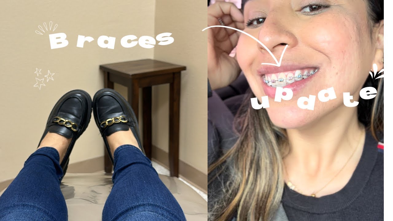 ONE YEAR BRACES UPDATE || TEETH CLEANING