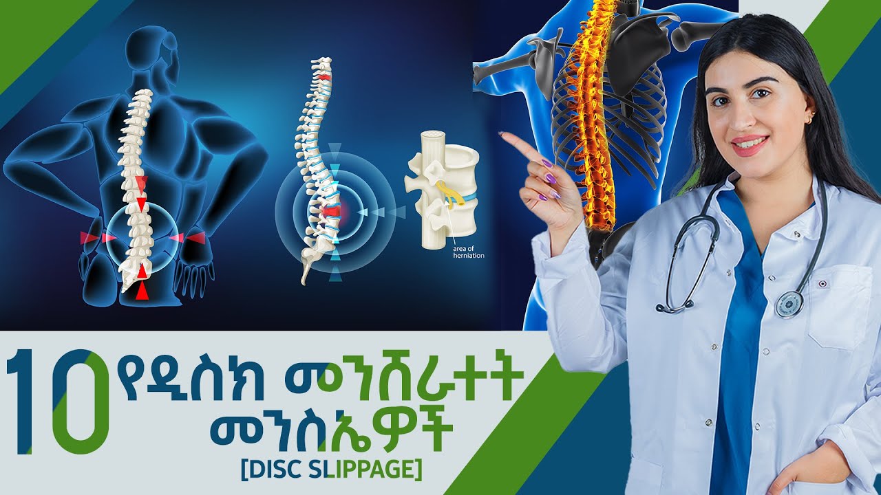 የወገብ እና የጀርባ ህመም መንስኤዎችና መፍትሄዎች |የዲስክ መንሸራተት | lower backpain  @Dr.SeifeWorku @tobiamedi @fetuntube