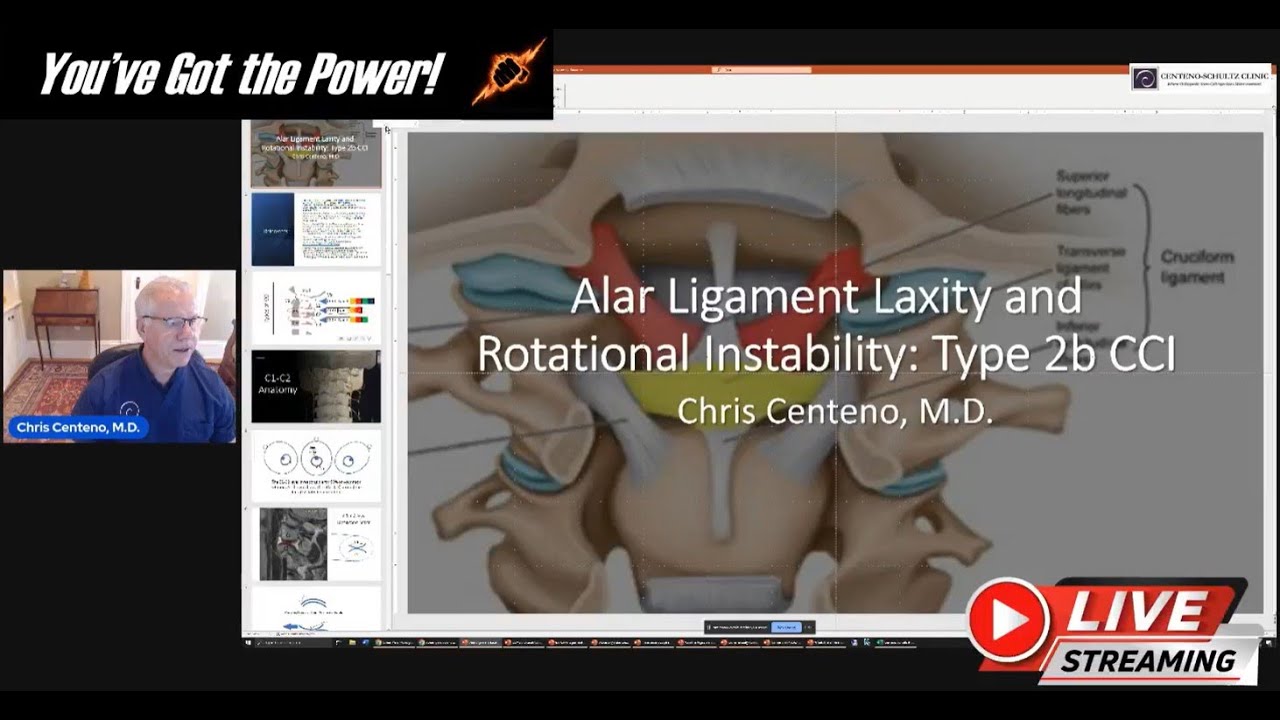 Alar Ligament Laxity and Rotational Instability: Type 2b CCI