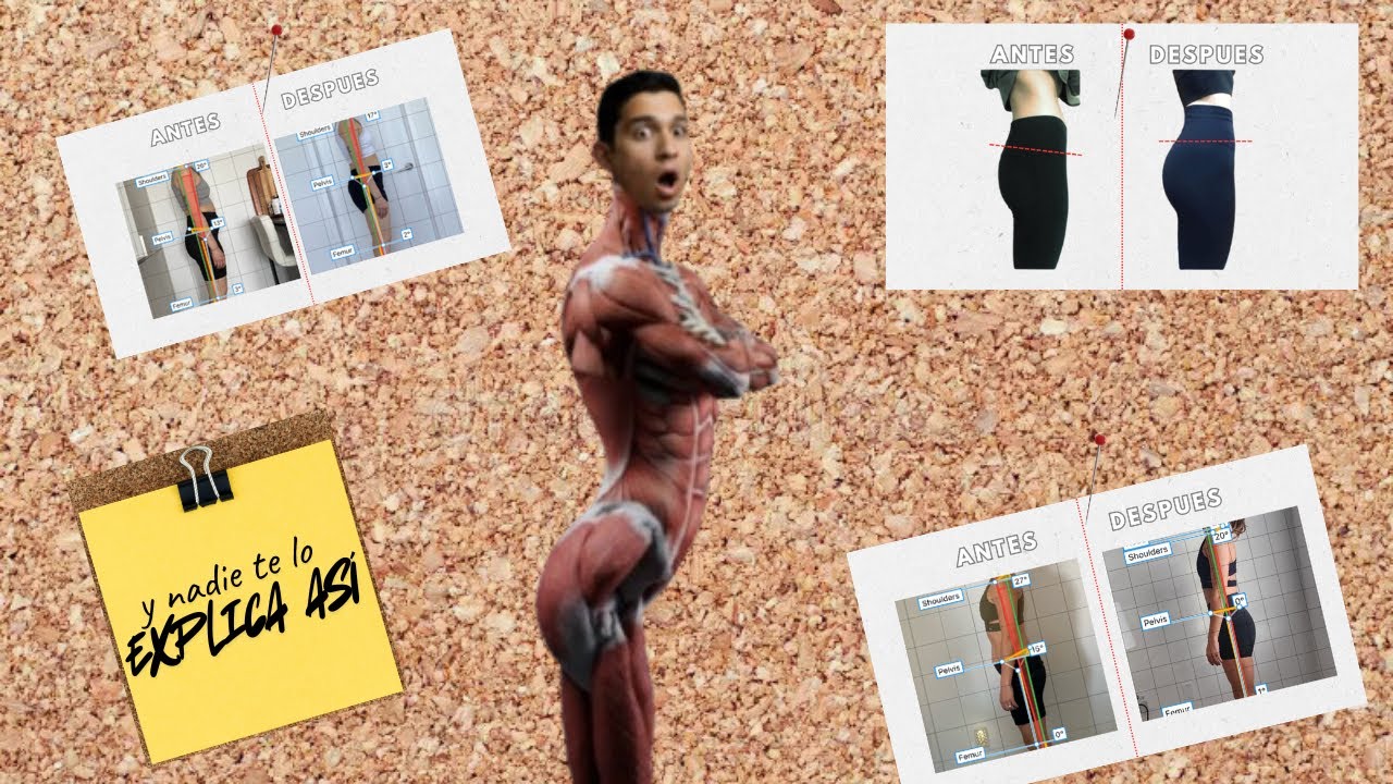 Tu dolor lumbar y glúteos planos tienen la misma causa