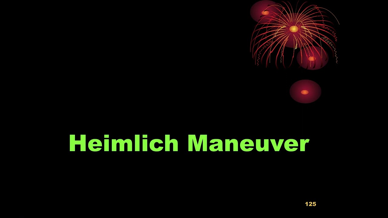 HEIMLICH MANOEUVRE, A LIFE SAVING IN CHOKING, WE ALL SHOULD LEARN,LECTURE LINK IN DESCRIPTION #short