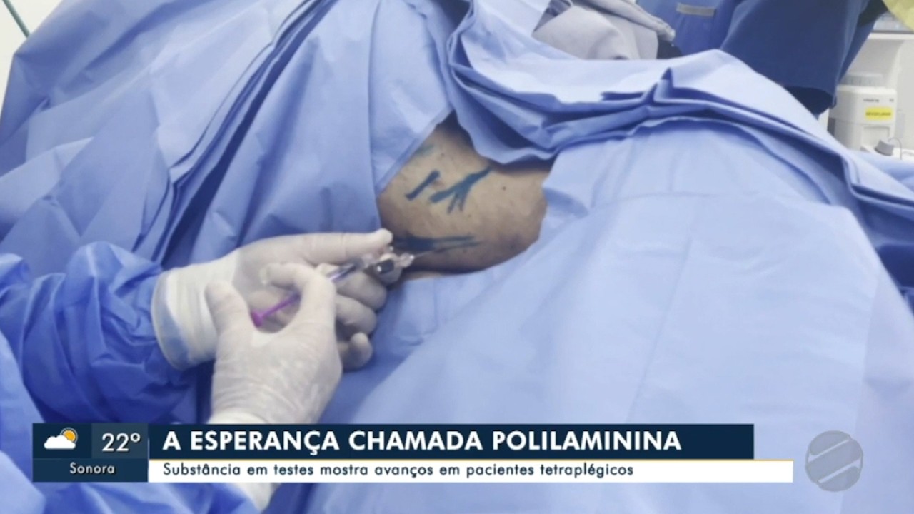 Reportagem do G1 - Aplicação da Polilaminina - 1º Caso em Mato Grosso do Sul