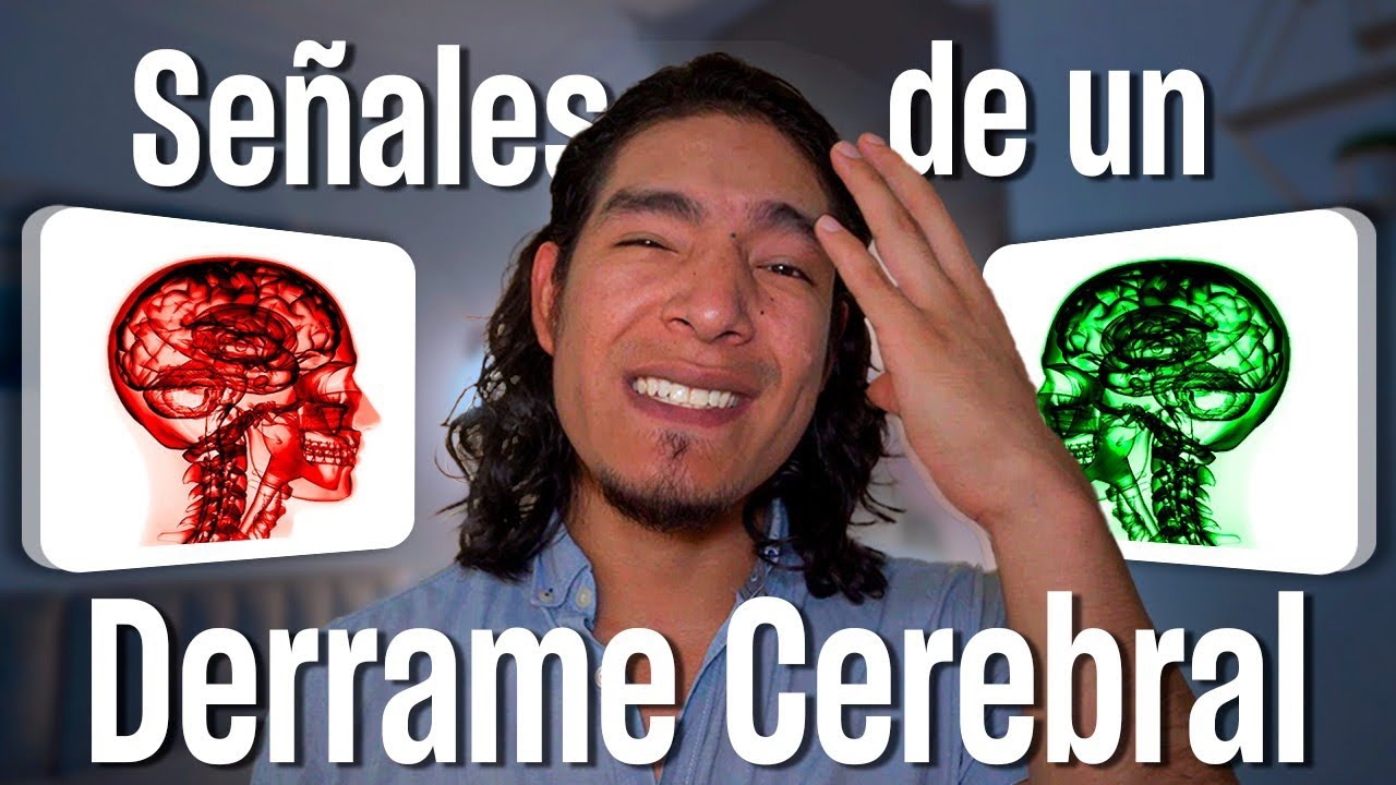 DERRAME CEREBRAL: TODO lo que debes SABER