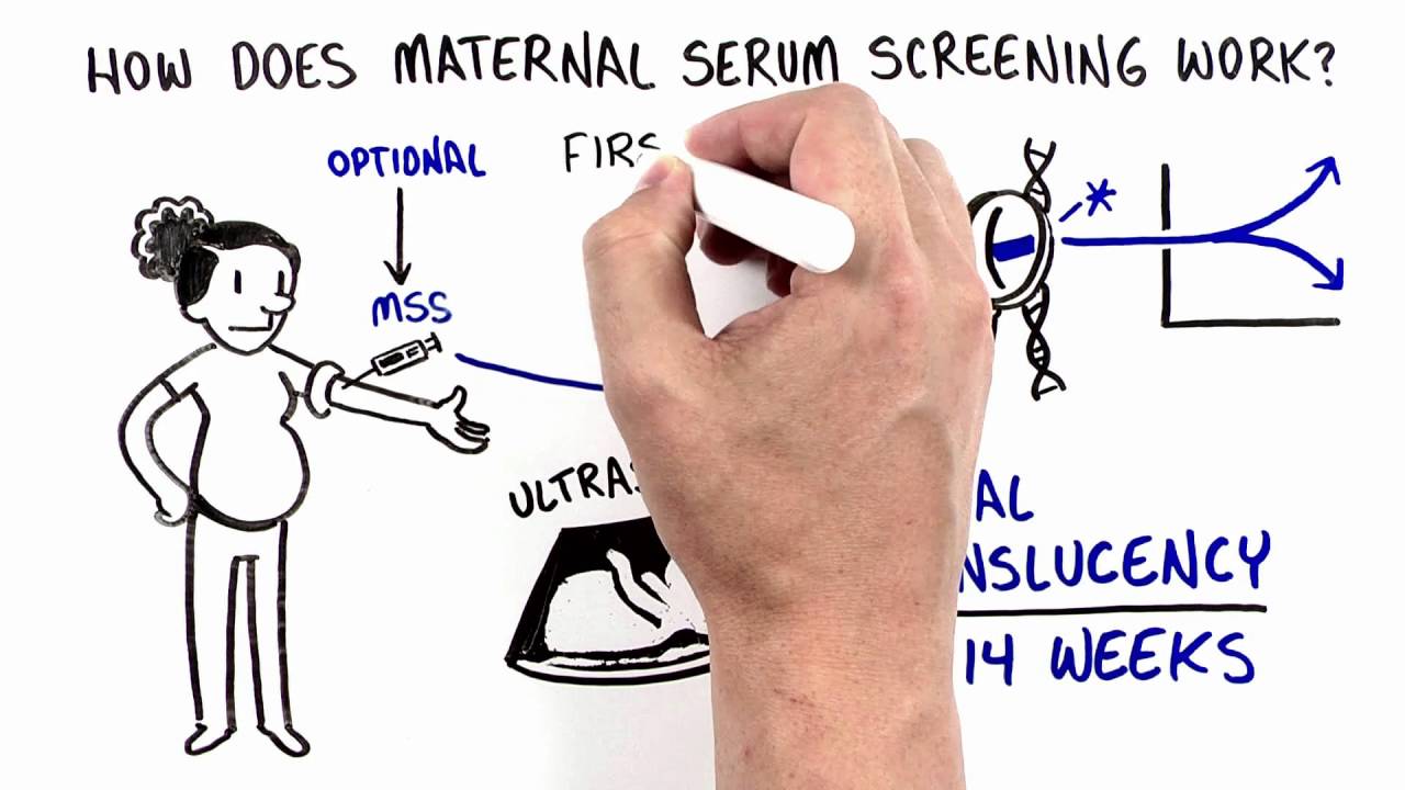 Maternal Serum Screening (MSS)