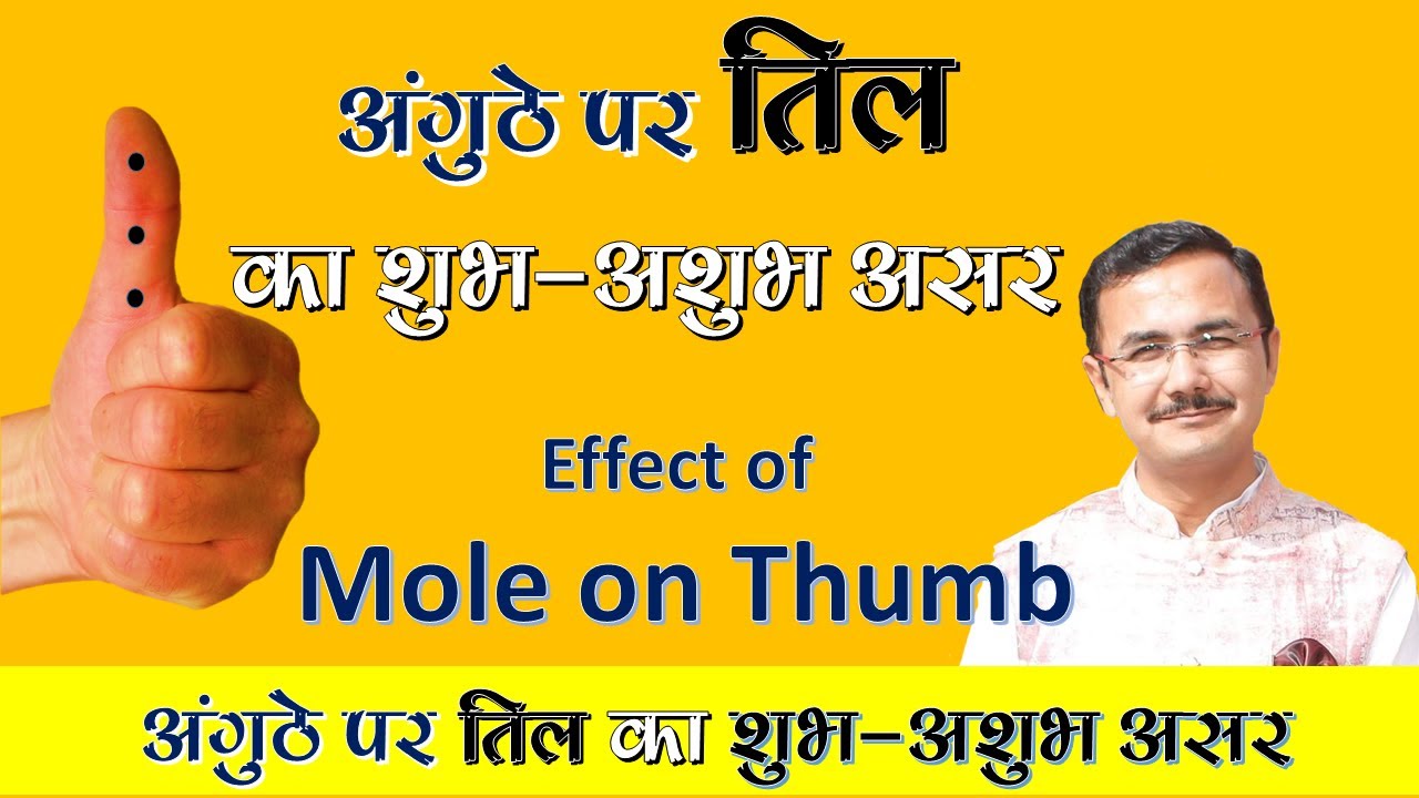 अंगूठे के पहले और दुसरे पर्व में तिल का प्रभाव || Mole sign on thumb & its effect on both phalanges