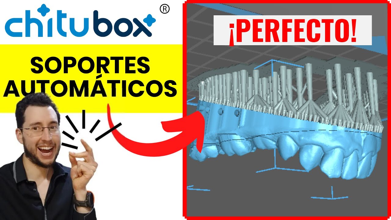 🪄 Soportes AUTOMÁTICOS PERFECTOS  - Guía de CHITUBOX con 1️⃣ clic .!
