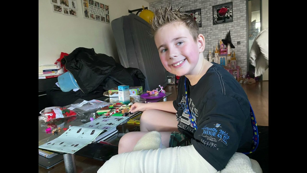 Het verhaal over mijn gebroken arm