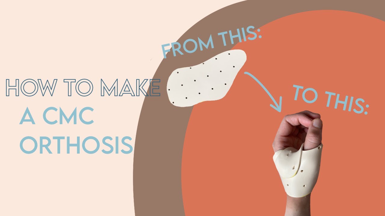 How to Make a CMC Orthosis