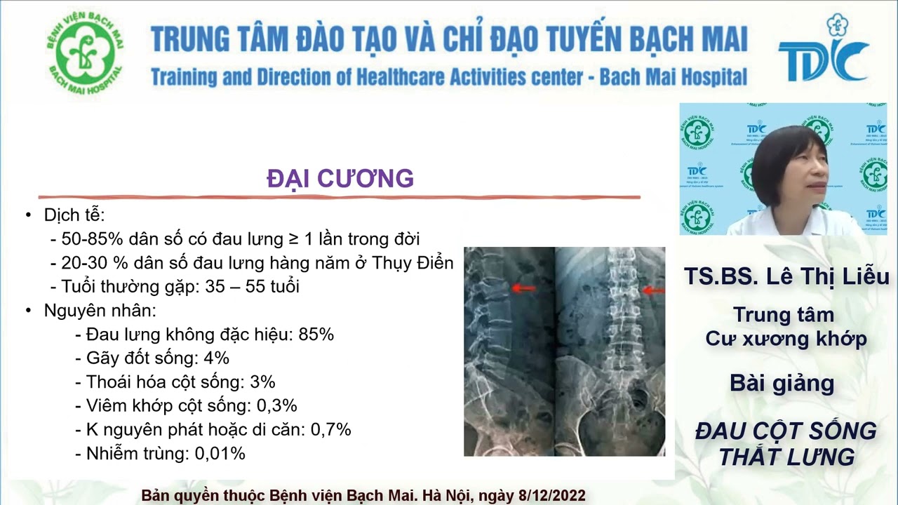 Đau cột sống thắt lưng