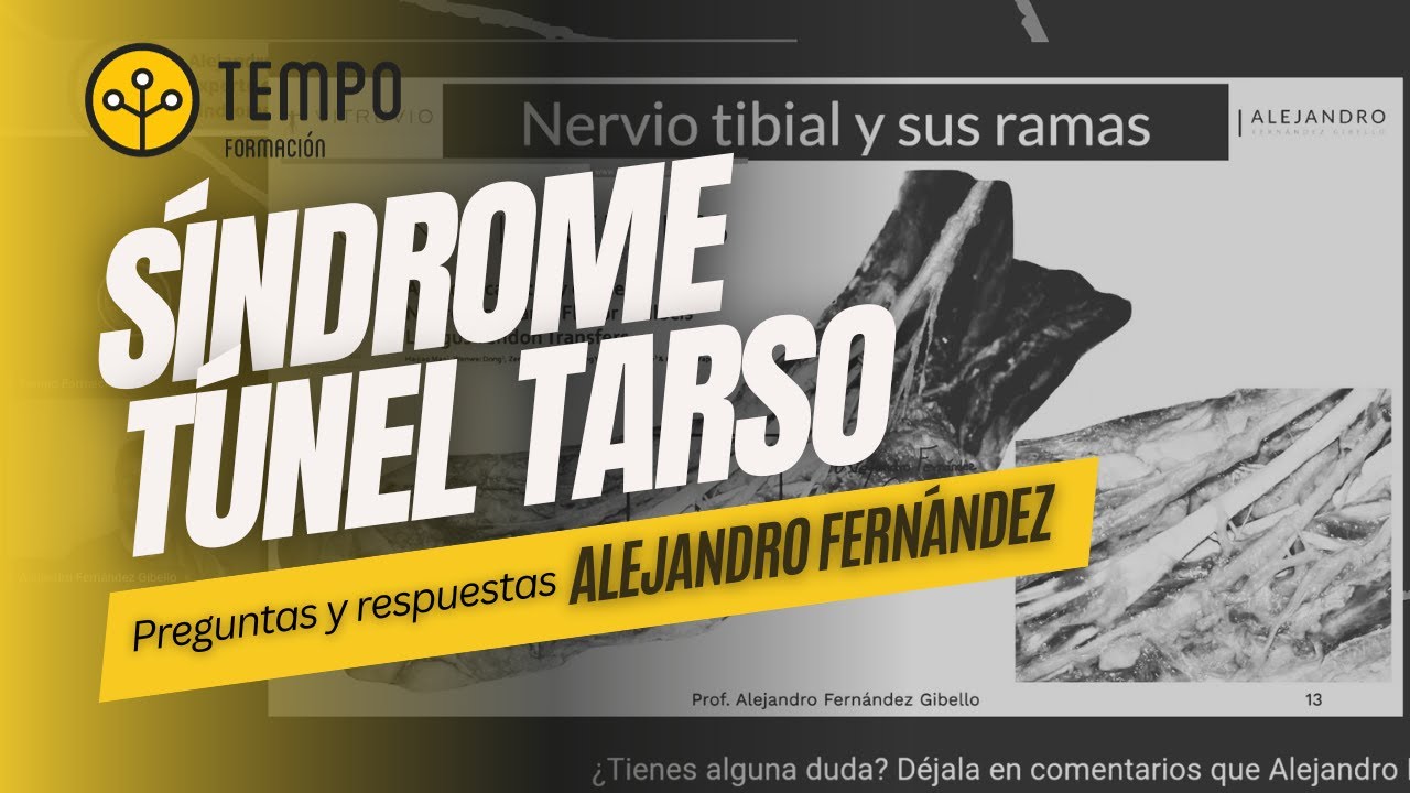 Preguntas y respuestas sobre el Síndrome Túnel Tarso con Alejandro Fernandez