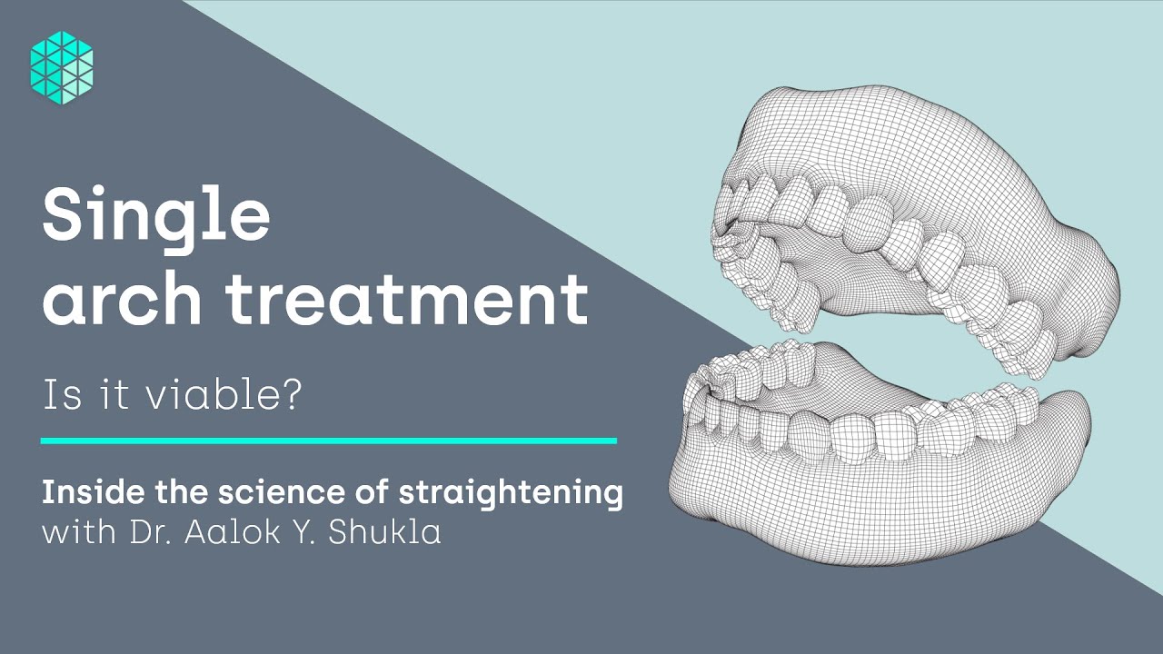 Single arch treatment - is it viable? | Inside the science of teeth straightening