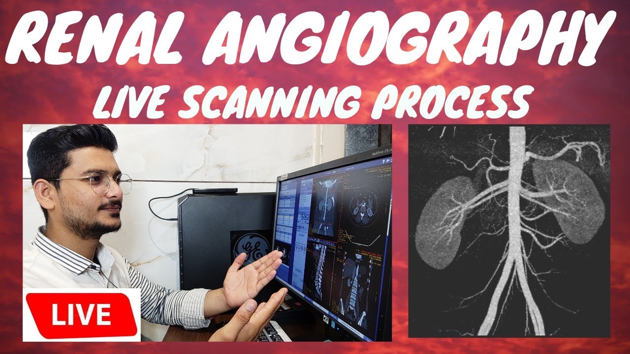 CT RENAL ANGIOGRAPHY LIVE SCAN | Live ct scan of renal/abdominal Angiography #radiologytechnologist