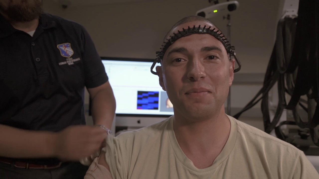 Brain Stimulation