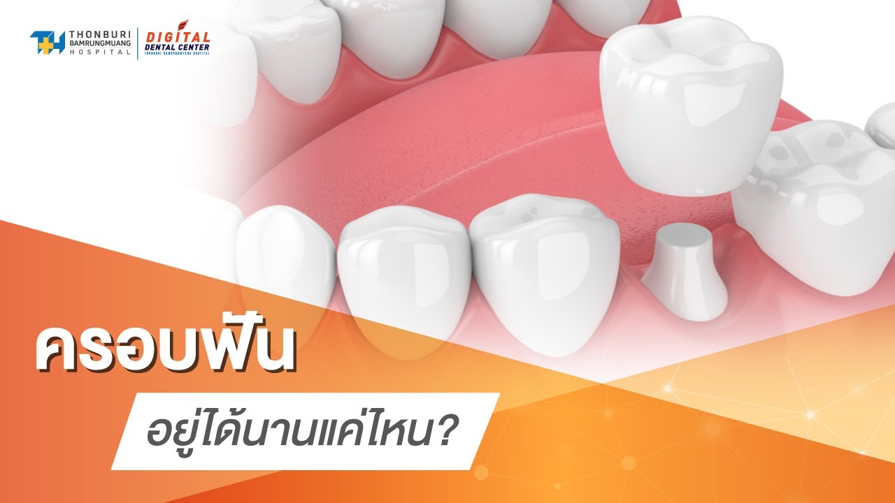 ครอบฟัน อยู่ได้นานขนาดไหน | 𝐃𝐢𝐠𝐢𝐭𝐚𝐥 𝐃𝐞𝐧𝐭𝐚𝐥 𝐂𝐞𝐧𝐭𝐞𝐫