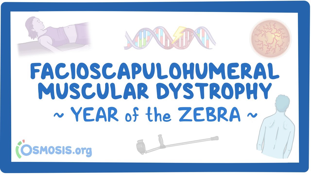 Facioscapulohumeral muscular dystrophy (Year of the Zebra)