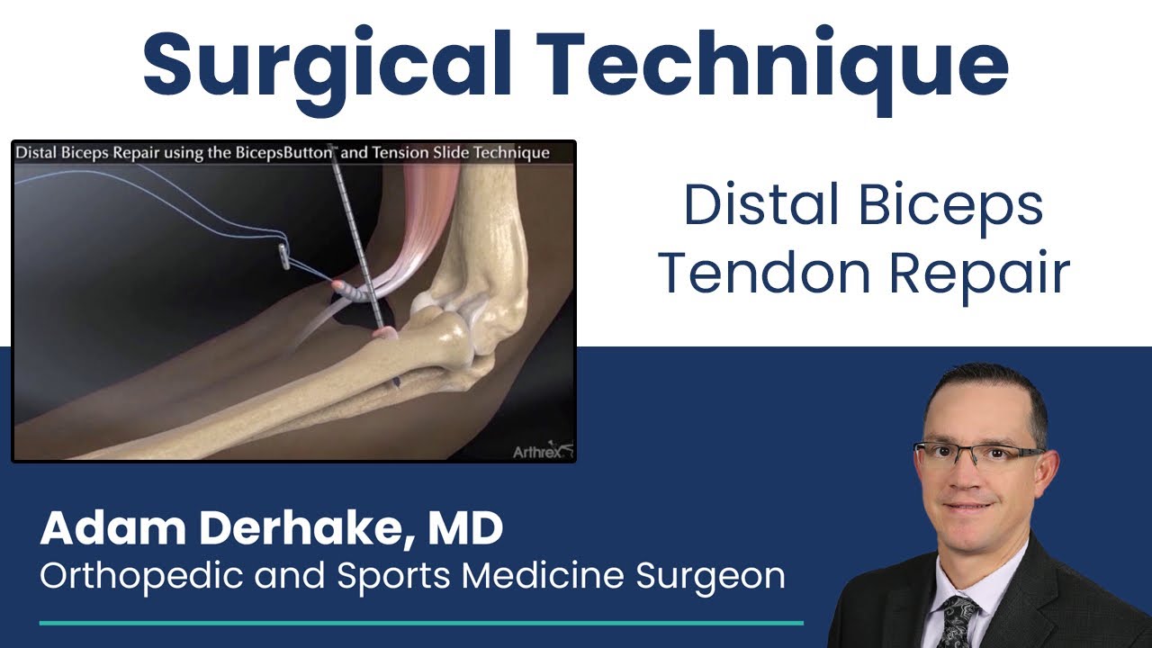 Distal Biceps Tendon Repair: Surgical Technique