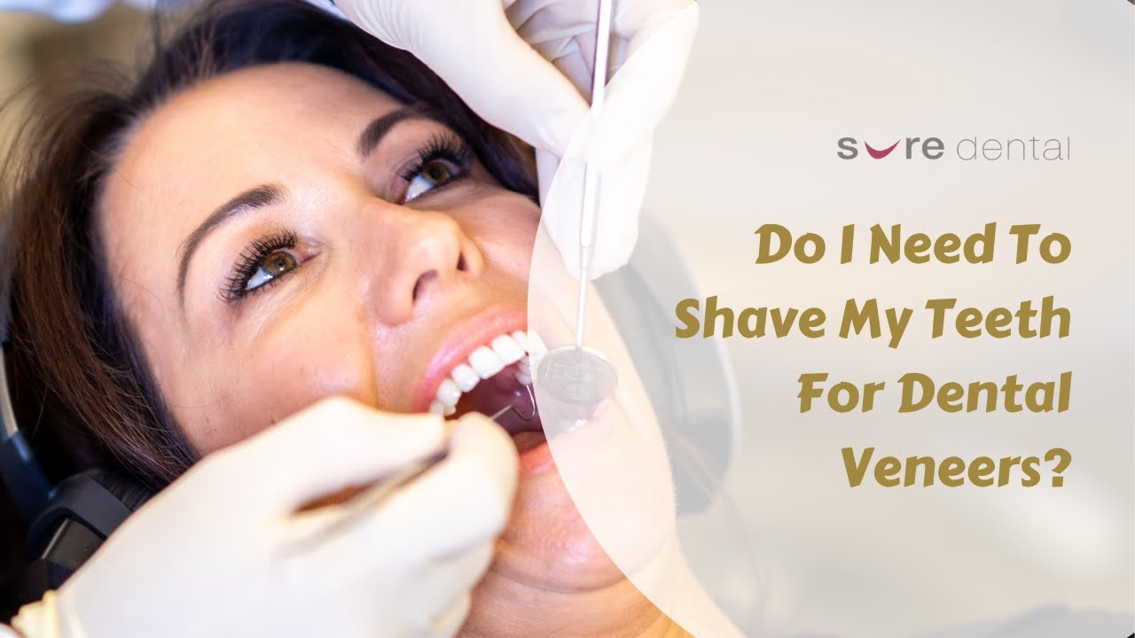 Do I Need To Shave My Teeth For Dental Veneers