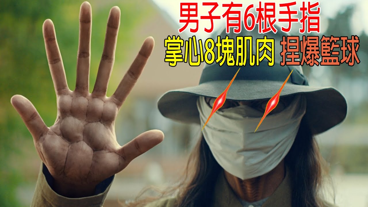 男子6根手指，掌心8塊肌肉，能捏爆籃球！戰鬥力10萬以上