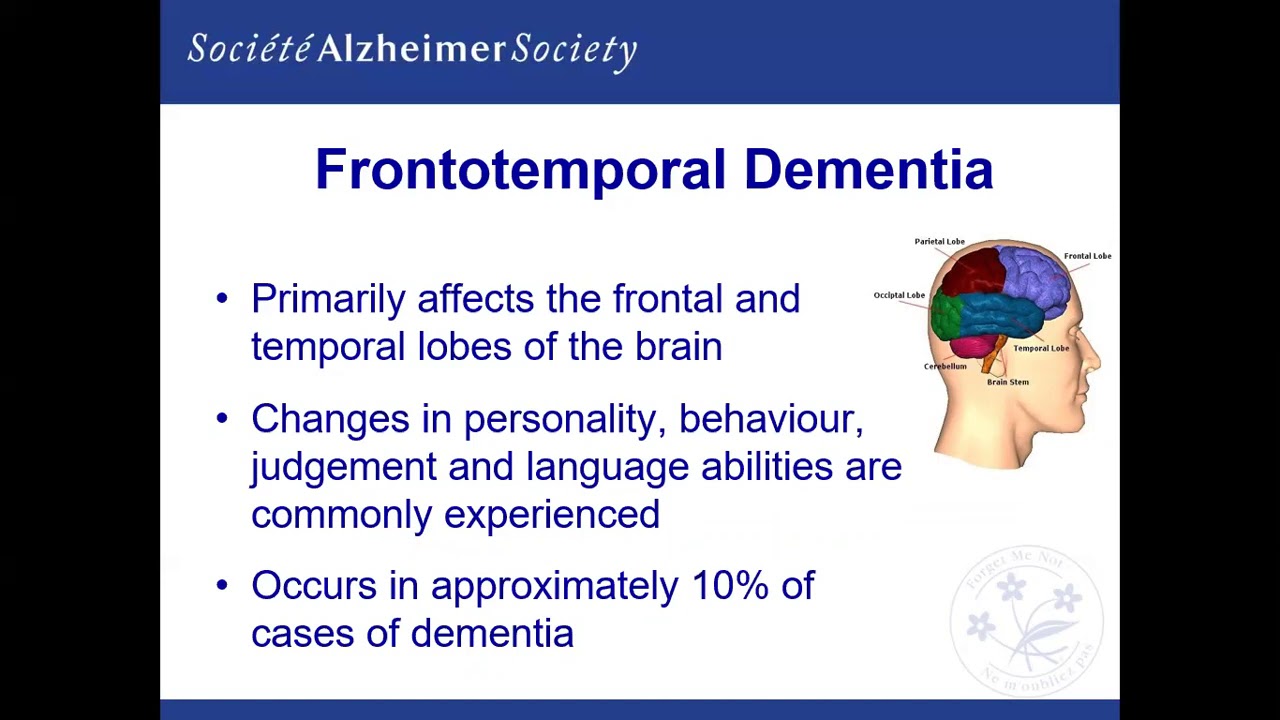 An Overview of Alzheimer's Disease and Dementia