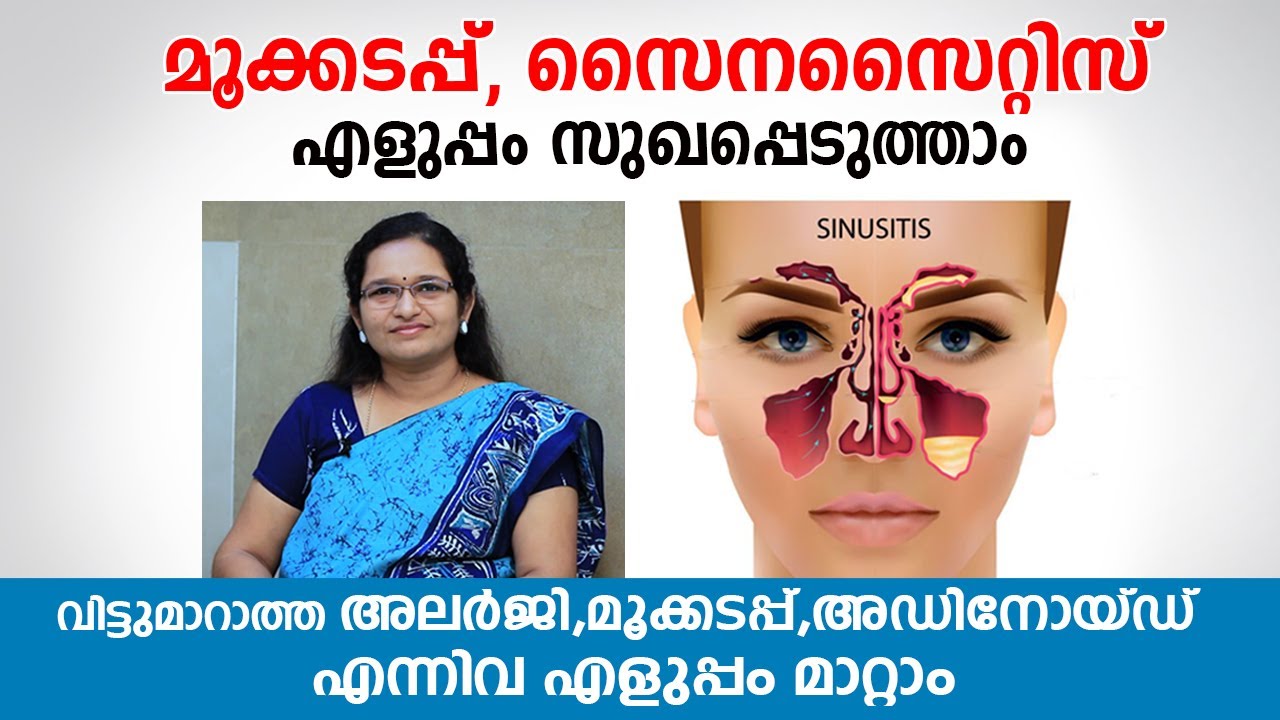 മൂക്കടപ്പ്, സൈനസൈറ്റിസ് എളുപ്പം സുഖപ്പെടുത്താം | Nasal congestion and Sinusitis |  Dr Anitha TV