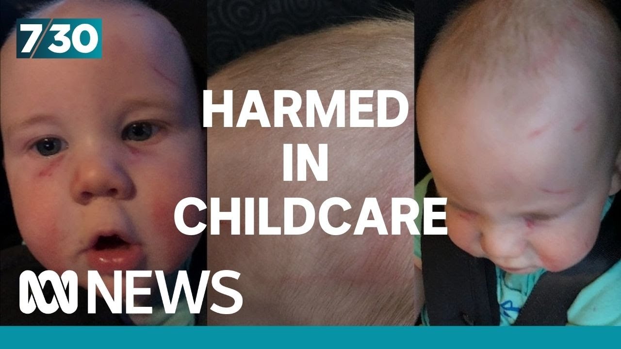 The alarming rise of children being injured at childcare | 7.30