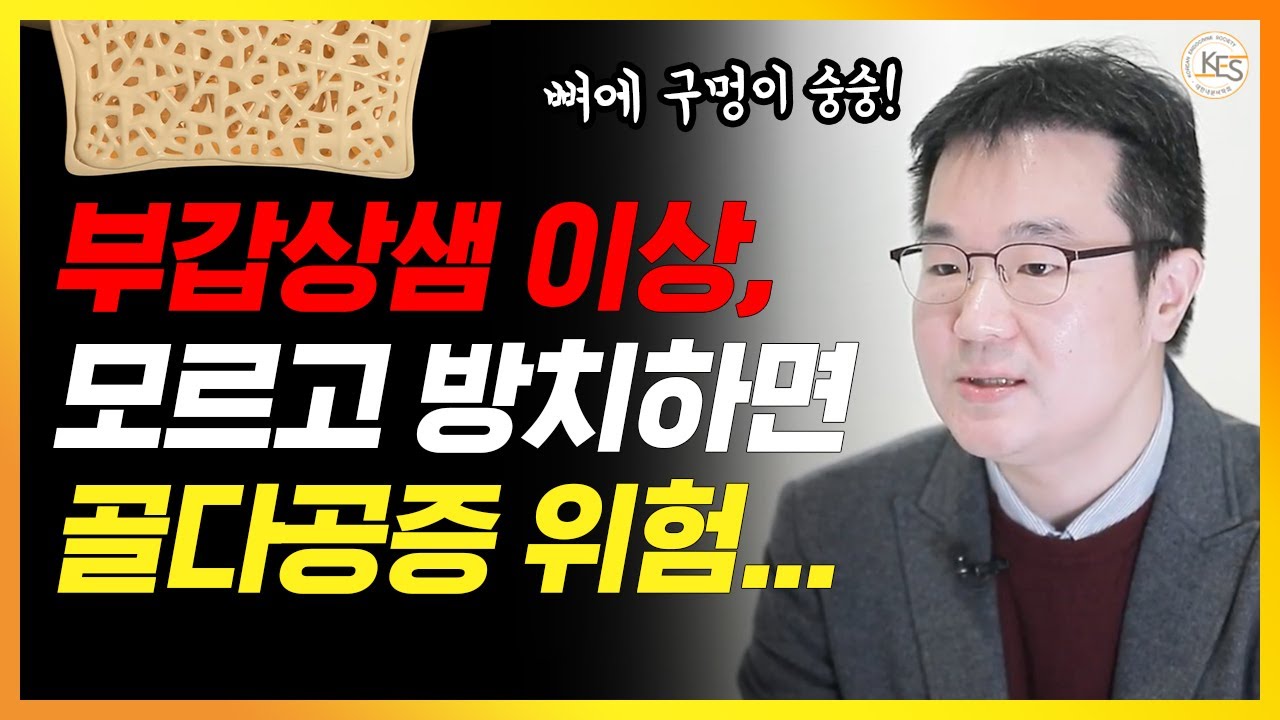 이걸 방치하면 뼈가 부러지고 요로결석의 원인이 될 수 있습니다 | 만성피로, 골다공증, 요로결석을 유발하는 질환 | 부갑상샘이상