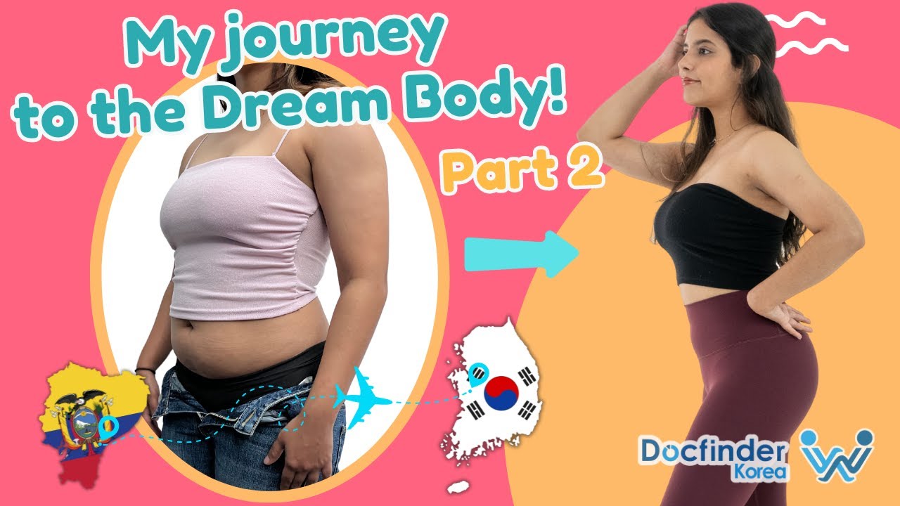 My jeans got too big! 3 months Post OP | Part 2 | Full Body Liposuction and Rhinoplasty in Korea