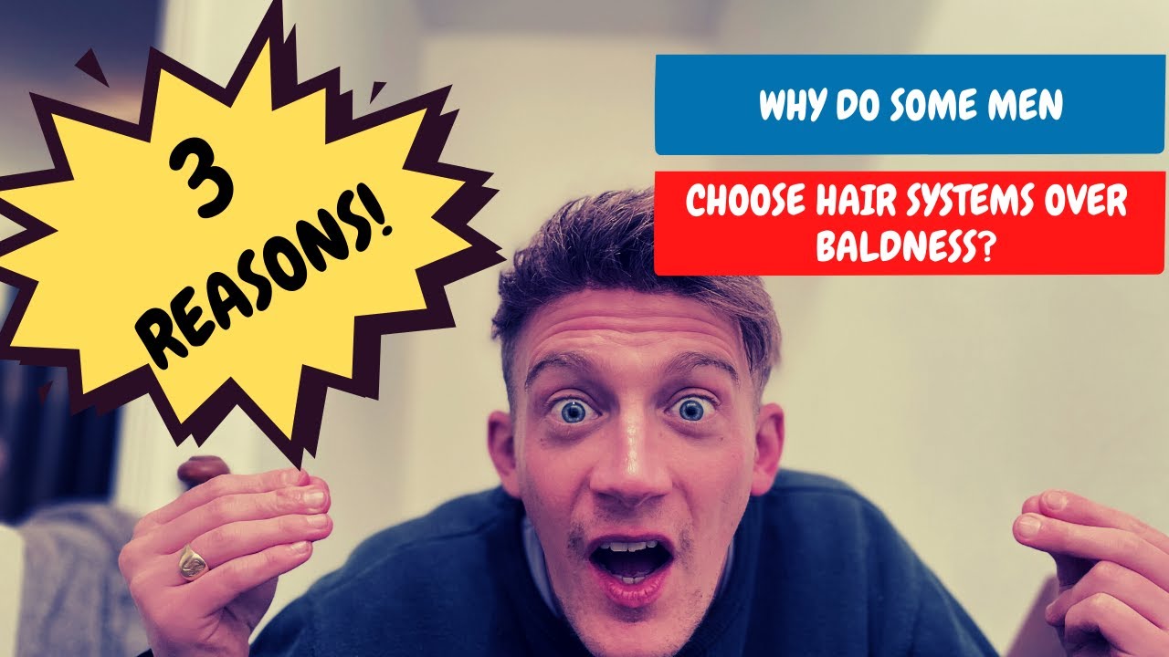 3 Reasons Guys Choose Hair Systems Over Going Bald