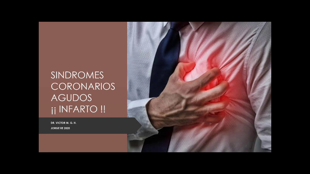 INFARTOS // SINDROMES CORONARIOS AGUDOS CON Y SIN ELEVACION ST