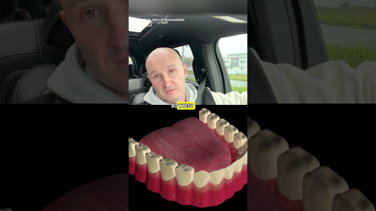 MOSTY CYFRONOWE w TECHNICE CAD/CAM? 💻🦷 Dentysta: DLACZEGO CYFRONA PREYZCJA to DZIŚ PODSTAWA!