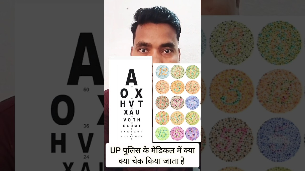 UP  Police Ka Medical Kaise Hota hai | UP Police Constable Medical 2024 #viralvideo #uppolice