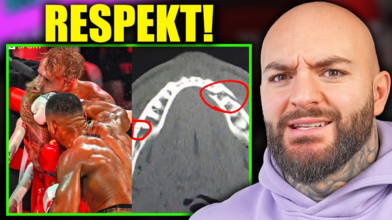 DOPPELTER Kieferbruch! Anthony Joshua zerst&ouml;rt Jake Paul... RINGLIFE