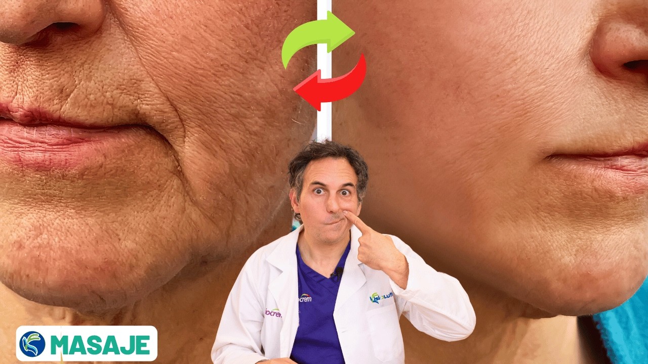 Bruzda nosowo-wargowa: jak ją usunąć bez operacji (21-dniowe wyzwanie)