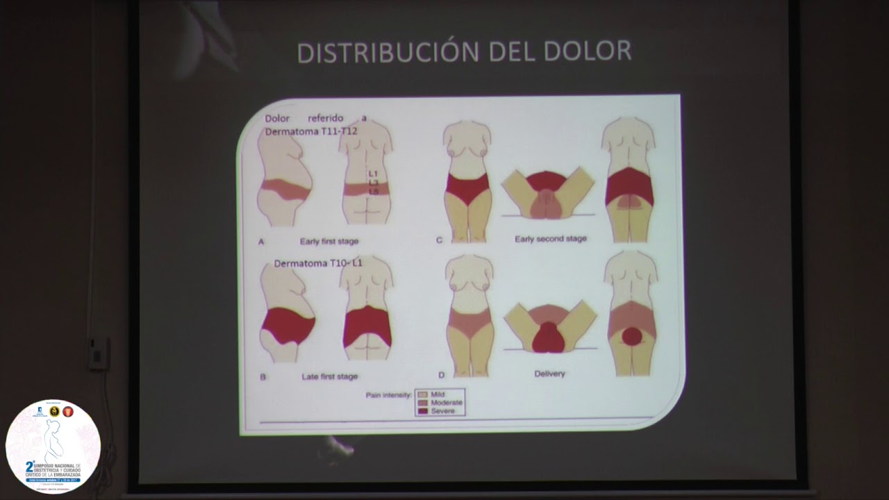 Analgesia Obstétrica Dr. Jorge Eduardo Bonnet y Dra Karla Farias