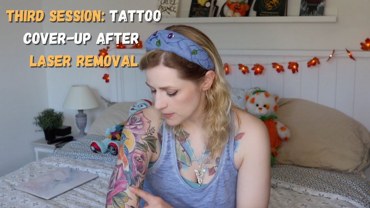3rd Session: Tattoo Cover-Up After Laser Tattoo Removal
