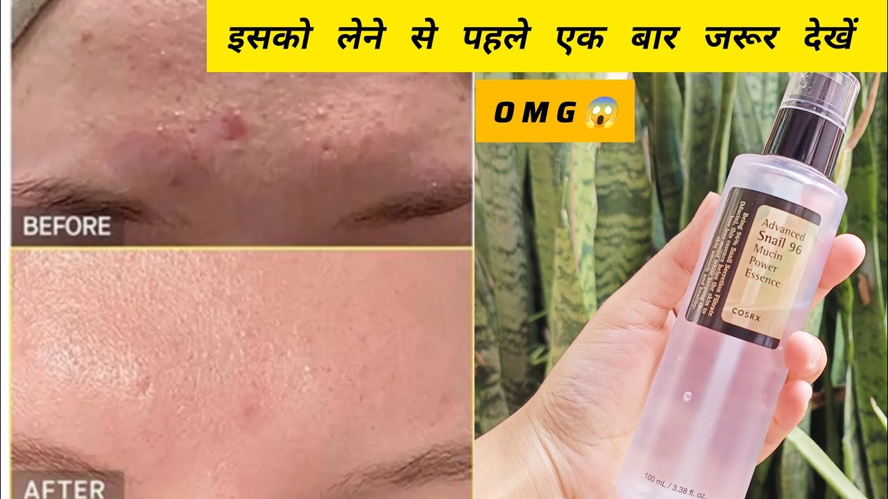 COSRX* snail mucin🐌 non sponsored honest review// does it really worth the hype 🤨 #snailmucin