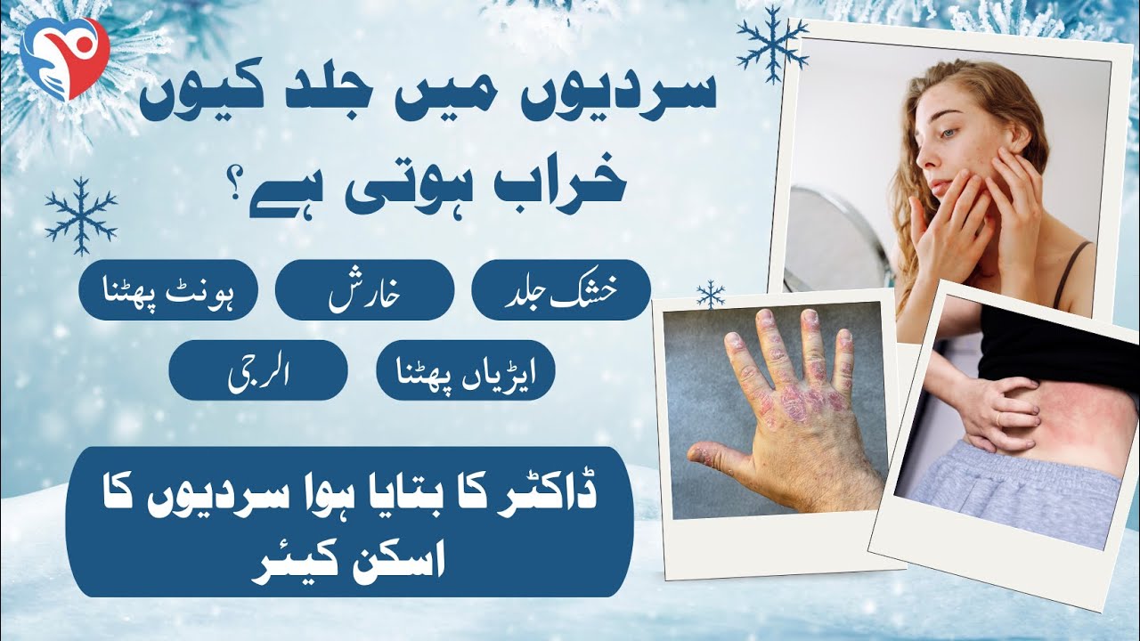 Dry Skin, Itching & Cracked Heels in Winter I Winter Skin Care Tips by Doctor Syed Noman Mashhadi
